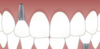 clinica dentara Elveto Dent