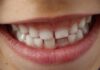 Igiena dentară la copii: ghid complet pentru o sănătate orală impecabilă Igiena dentară la copii