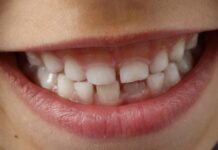 Igiena dentară la copii
