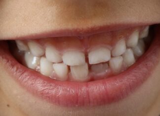 Igiena dentară la copii: ghid complet pentru o sănătate orală impecabilă Igiena dentară la copii