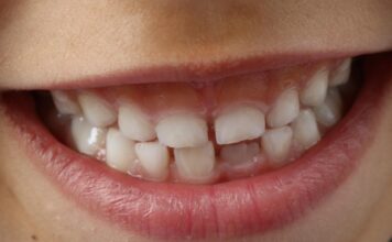 Igiena dentară la copii