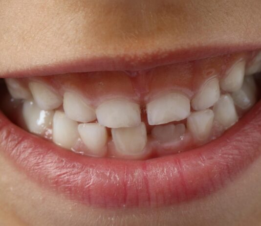 Igiena dentară la copii: ghid complet pentru o sănătate orală impecabilă Igiena dentară la copii