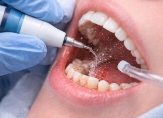 Detartraj: cât de des se recomandă și ce beneficii are pentru gingii elveto-dent.ro
